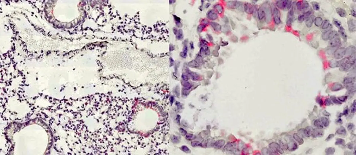 کشف یک روش جدید برای درمان بیماری‌های تنفسی