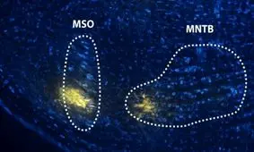 مغز چطور تفاوت صحبت و صدا را تشخیص می‌دهد؟