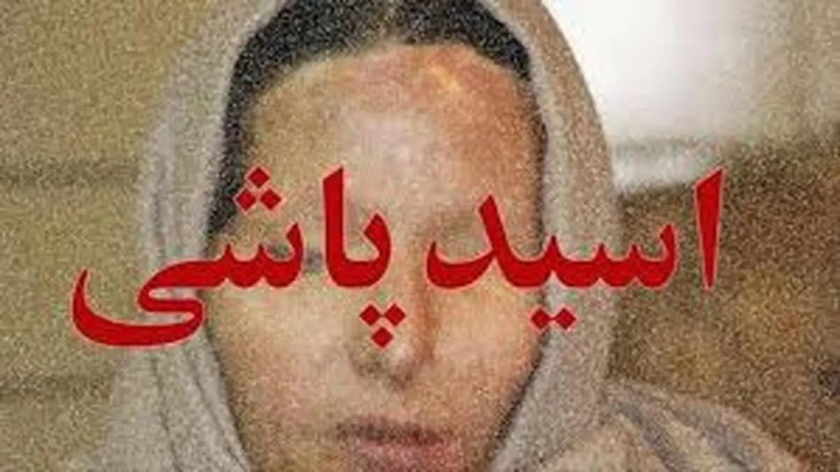 اسیدپاشی به زن جوان در مسیر دادگاه خانواده/ شوهرش احضار شد
