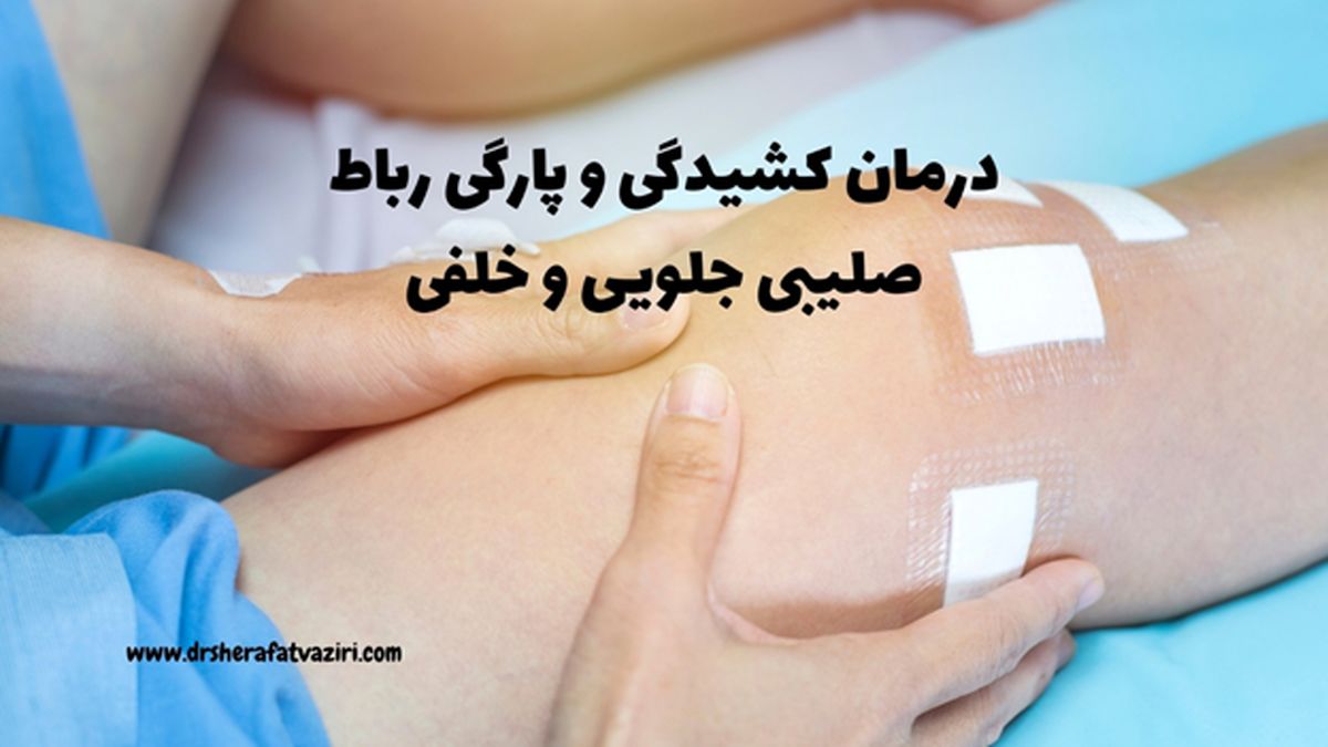 درمان کشیدگی و پارگی رباط صلیبی جلویی و خلفی