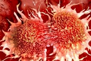 ۴ عامل مرتبط با سرطان که در سال ۲۰۲۰ شناسایی شدند