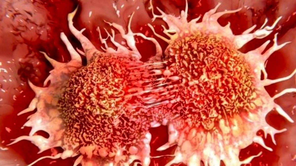 ۴ عامل مرتبط با سرطان که در سال ۲۰۲۰ شناسایی شدند