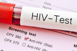 معمای ورود HIV به ایران| پای فرانسه در میان بود