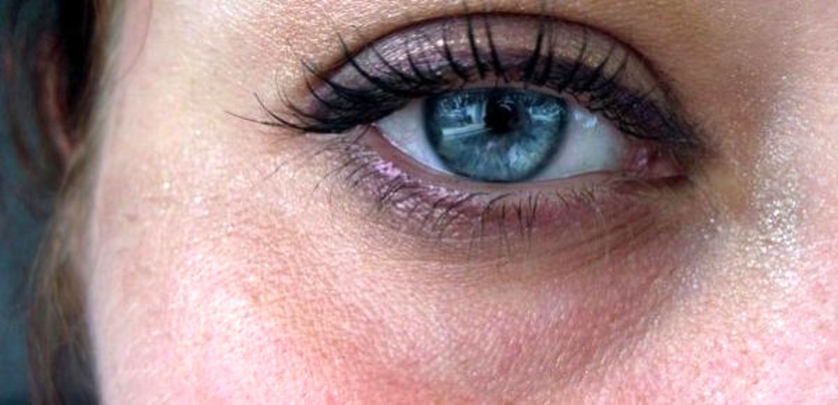  ۵ روش درمان خشکی چشم