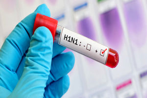 آنفلوانزای H۱N۱ مهمان جدید بیمارستان های ساوه