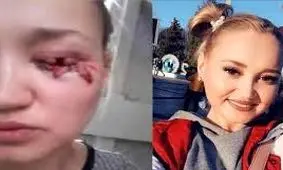 سگ ولگرد چشم دختر زیبا را درآورد/ ویدئو+16