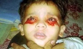 دختری که خون گریه می‌کند!