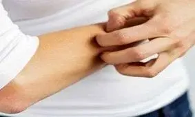 چه زمانی خارش بدن هشدار یک بیماری جدی است؟
