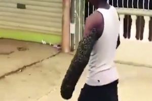 پسری که برای انتقال زنبورهای مزاحم دست خود را به کندو تبدیل کرد!/ ویدئو