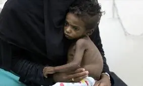 تروریستی خواندن انصارالله، یمن را به قحطی سوق می دهد