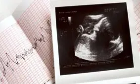 انتقاد شدیداللحن مجری تلویزیون و فعال حقوق بیماران SMA به احتمال حذف غربالگری!