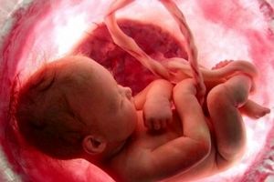 ۷ هزار سقط جنین شرعی در ۷ سال