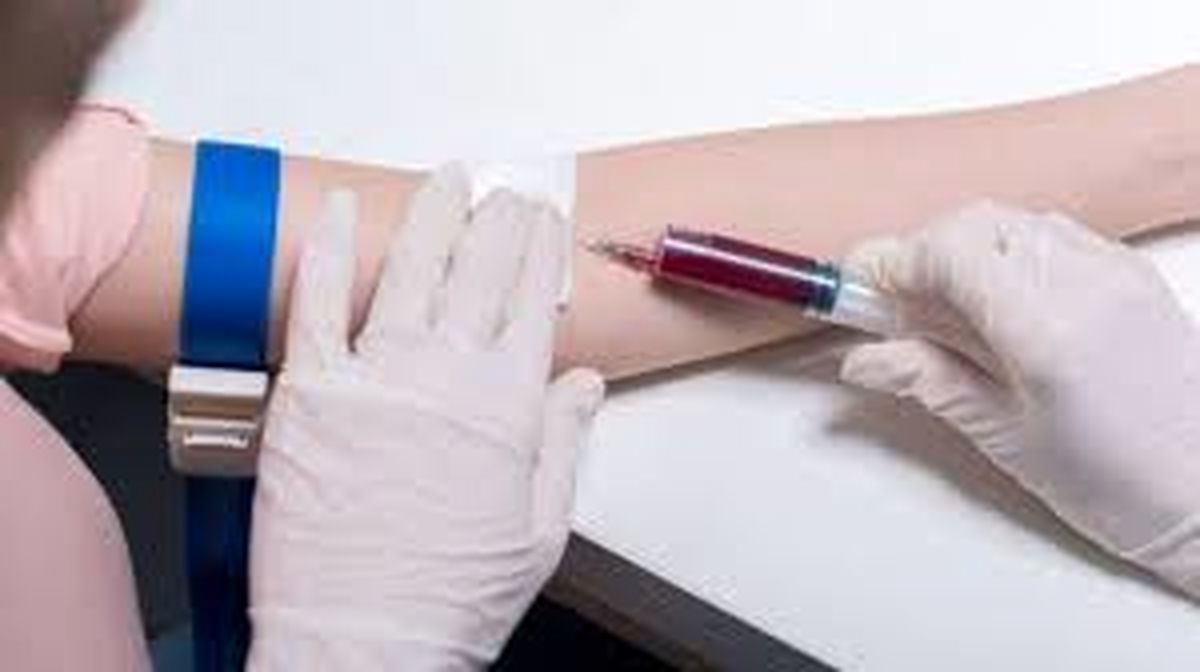 به ۴۰سالگی که رسیدید، آزمایش خون بدهید / کلسترول بالا می‌تواند خود را به‌صورت بیماری پوستی نشان دهد