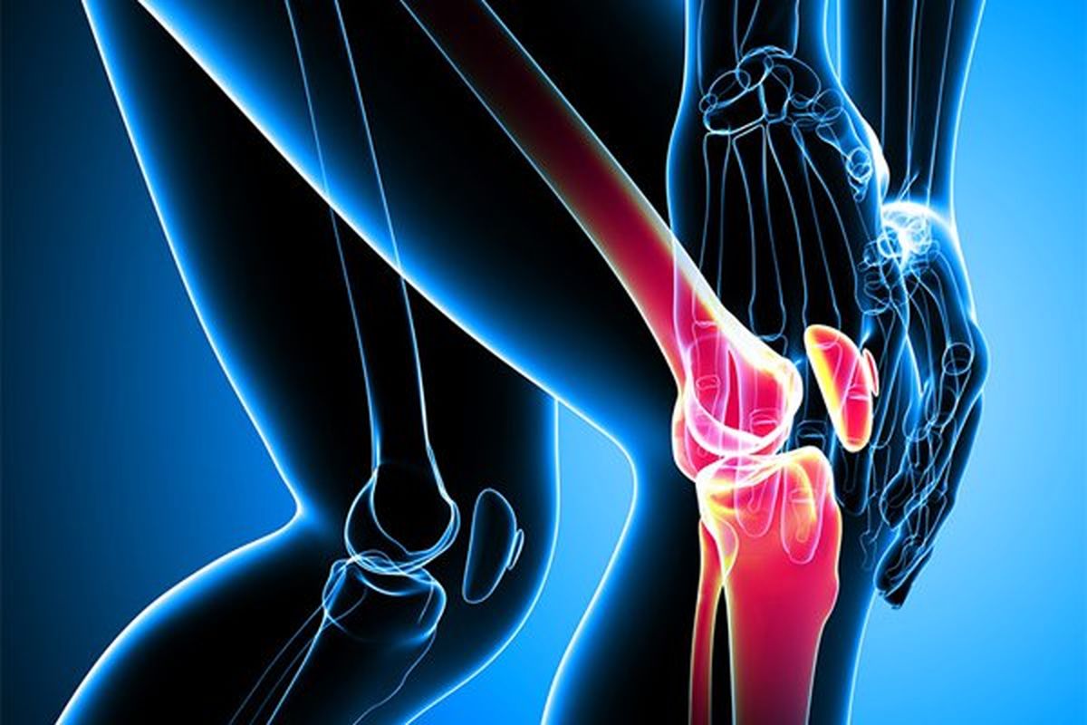 راههای جلوگیری از پیشرفت پوکی استخوان