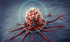 علایم و درمان سومین سرطان شایع زنان / مردان هم می‌توانند واکسن HPV بزنند