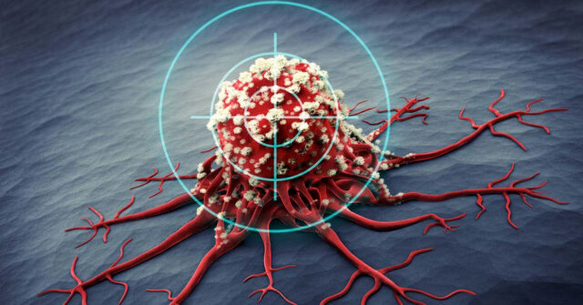 علایم و درمان سومین سرطان شایع زنان / مردان هم میتوانند واکسن HPV بزنند
