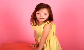 مدل شدن کودک مبتلا به سندرم داون/ تصاویر