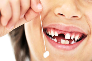 رسیدگی به دندان‌های شیری را جدی بگیرید تا دائمی‌ها در جای درست رشد کنند