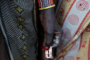 ختنه زنان؛ زخمی که هیچوقت درمان نمی‌شود