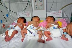 تولد نوزادان سه قلو در مرکز درمان ناباروری علوم پزشکی اردبیل