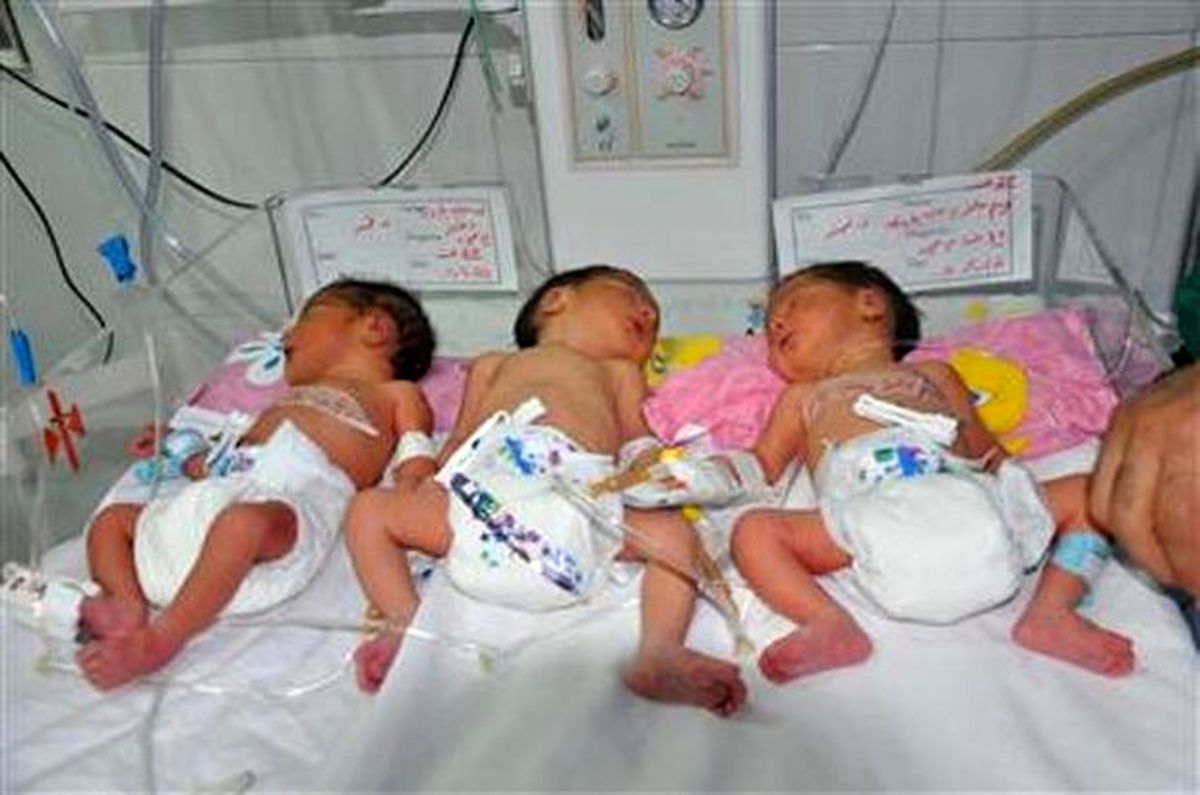 تولد نوزادان سه قلو در مرکز درمان ناباروری علوم پزشکی اردبیل