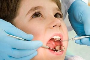 اولین چکاپ دندان‌ها برای کودکان در چه سنی مناسب است؟