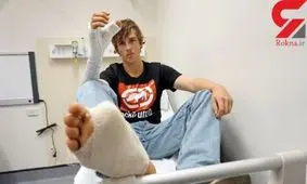 پیوند شست پا یک کارگر به شست دست! +عکس