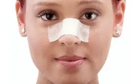 افزایش آمار جراحی‌های زیبایی بینی همزمان با شیوع کرونا