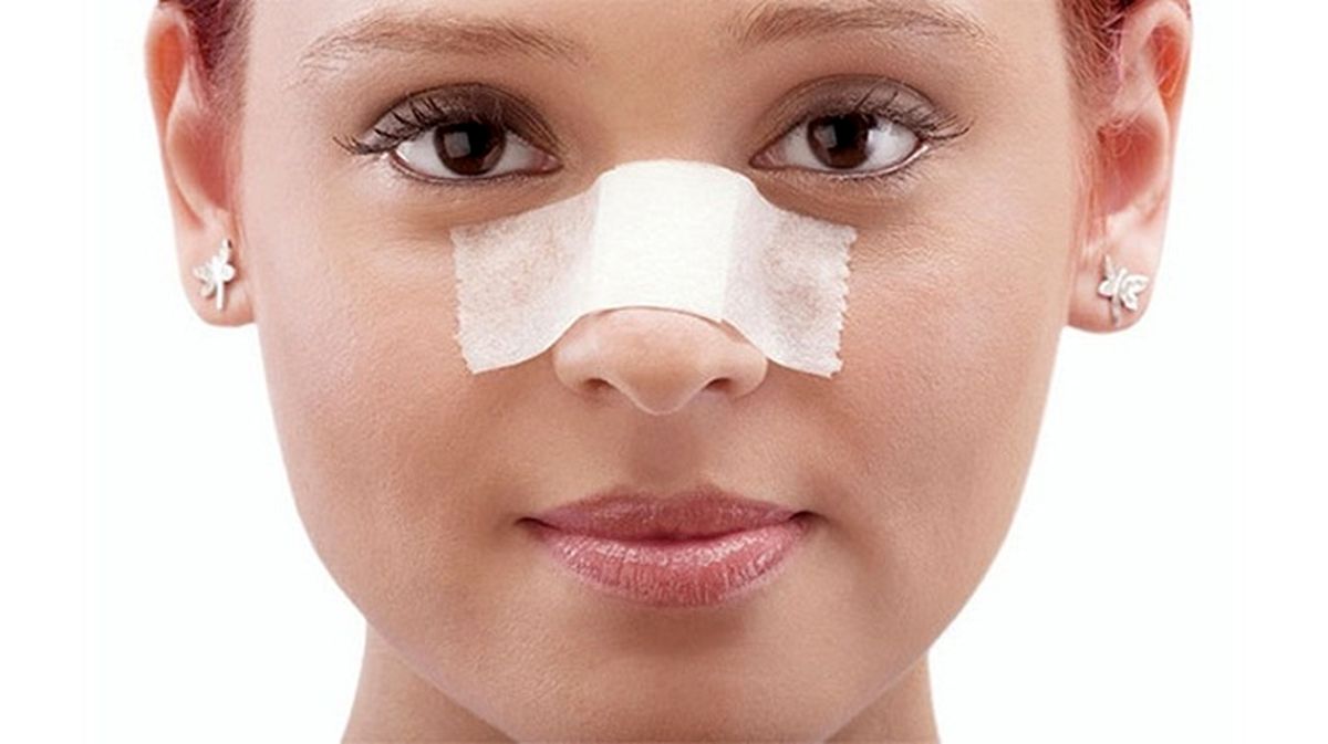 افزایش آمار جراحیهای زیبایی بینی همزمان با شیوع کرونا
