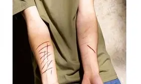 کشف بیش از ۳۰۰ مورد خودزنی با ادعای نزاع در همدان