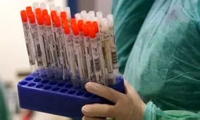 آنچه باید در خصوص تست‌های تشخیصی کرونا بدانیم