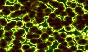 پیشگیری از گسترش باکتری‌های مقاوم در فاضلاب‌های شهری