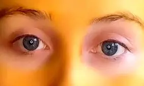 پشیمانی زن جوان در پی استفاده از ماسک زردچوبه!