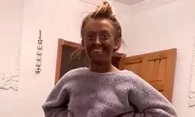 بلایی که کرم تقلبی بر سر صورت دختر جوان بریتانیایی آورد