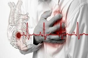 کاهش ۳۰ درصدی مشکلات قلبی مرگبار با کمک بازتوانی قلبی