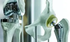 ایران در زمره کشورهای تولیدکننده «فلز تیتانیوم» قرار گرفت