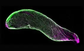 بررسی اسکلت انگل مالاریا