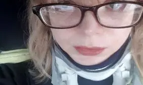 بیماری عجیبی که سر دختر ۲۷ ساله را از بدنش جدا کرد!