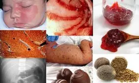 با ۱۰ اصطلاح خوشمزه پزشکی آشنا شوید/ تصاویر