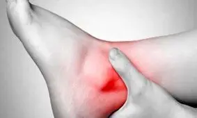 رگ‌های واریسی دارید، این باورهای غلط را کنار بگذارید