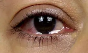 چشم؛‌ دریچه‌ای برای تشخیص بسیاری از بیماری‌ها