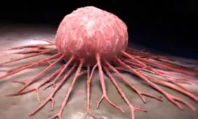 راهبرد جدید واکسیناسیون سلولی برای مقابله با سرطان