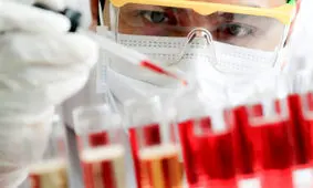 ترمیم زخم‌های دیابتی با استفاده از سلول‌های بنیادی بند ناف