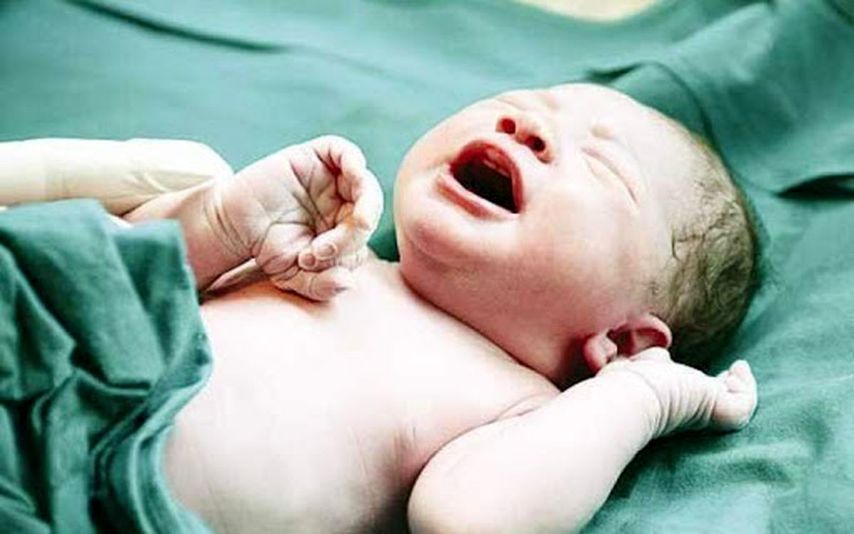 درمان ریفلاکس نوزادان