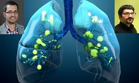 کشف یک واکنش سلولی غیرمنتظره در ریه افراد مبتلا به کرونا