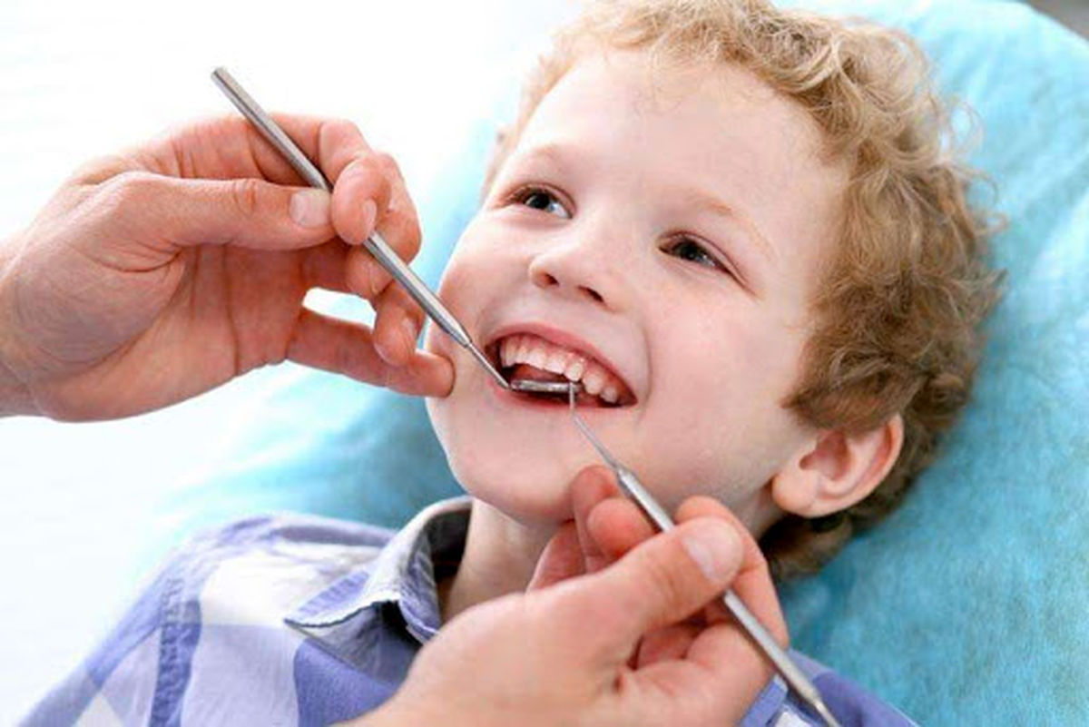۸۰ درصد کودکان ۵ تا ۶ سال پنج دندان پوسیده دارند