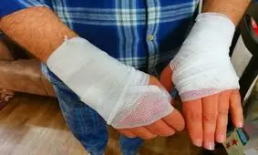 ماجرای دستان سوخته مامور پلیس و وانت بار مشتعل