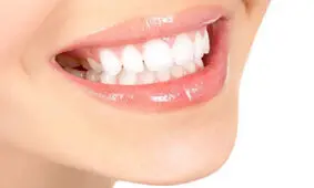 عفونت لثه مهم‌ترین عامل خرابی دندان است/ با زاویه ۴۵درجه مسواک بزنید