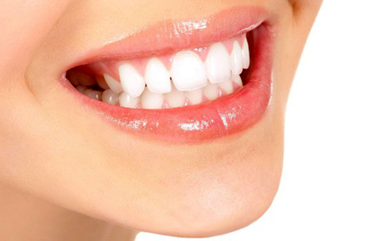 عفونت لثه مهم‌ترین عامل خرابی دندان است/ با زاویه ۴۵درجه مسواک بزنید