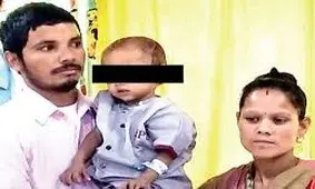 خارج کردن جنین مرده از شکم پسر ۱۸ ماهه